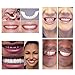 Yiwa Teeth Whitening Teeth Snap Cosmetic Denture False Teeth Easy Wear Oral Care