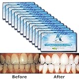 EZGO Supreme Teeth Whitening Strips 28 Count-14 Days Course, Tooth Whitening Whitestrips, Express Whitestrips with Professional Effect, Bonus Shade Guide Advanced New Formula (6% HP)