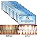 EZGO Teeth Whitening Strips - 28 Count 14 Days Course, Bonus Shade Guide Advanced New Formula, 6% HP, Whiten Your Teeth Faster