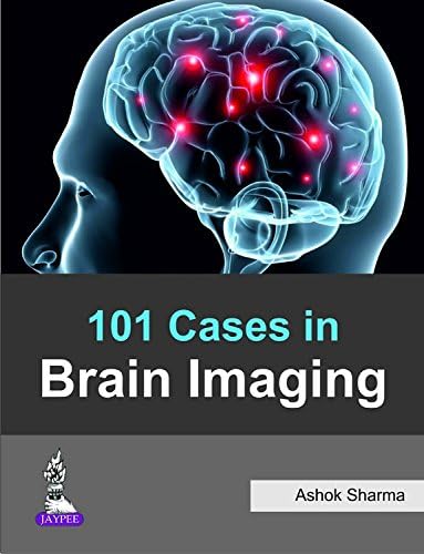101 Cases in Brain Imaging Paperback – 30 Jun 2016