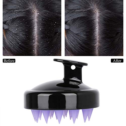 2Pack Hair Scalp Massager Shampoo Brush Wet and Dry Hair Scalp Brush