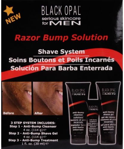 Black Opal Mens Razor Bumps Solution System Amazon Ca Health