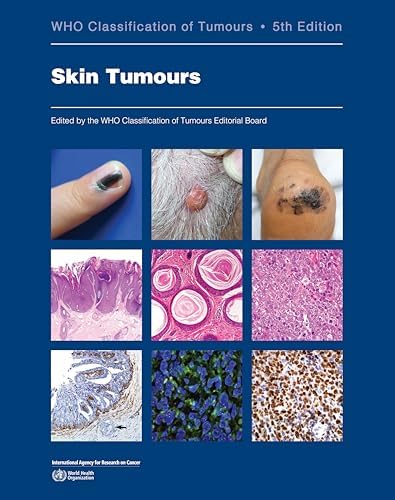 Breast Tumours: WHO Classification of Tumours (Medicine