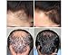 Hairmax Professional 12 Lasercomb