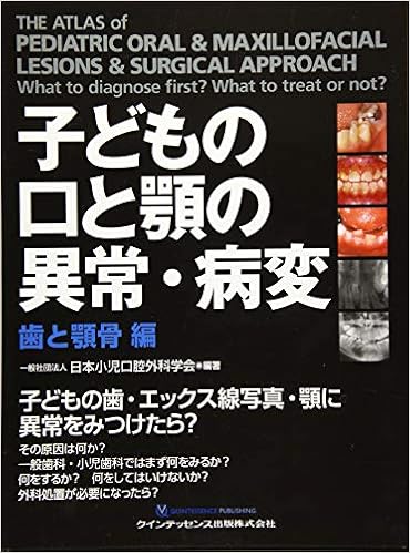 子どもの口と顎の異常・病変 歯と顎骨 編 (日本語) 単行本（ソフトカバー） – 2019/11/10