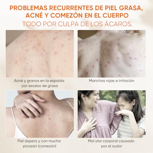 QUARXERY Gel de ducha antiácaros body wash - Eliminación profunda de ácaros y acné, limpieza suave para piel grasa-250ml