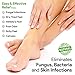 Foot Cure All Natural Foot Balm – Made in USA – for Dry Cracked Heels, Athletes Foot, Moisturizes Itchy Toes and Feet – Best Anti-fungal Cream to Remove Foot Callus.thumb 3