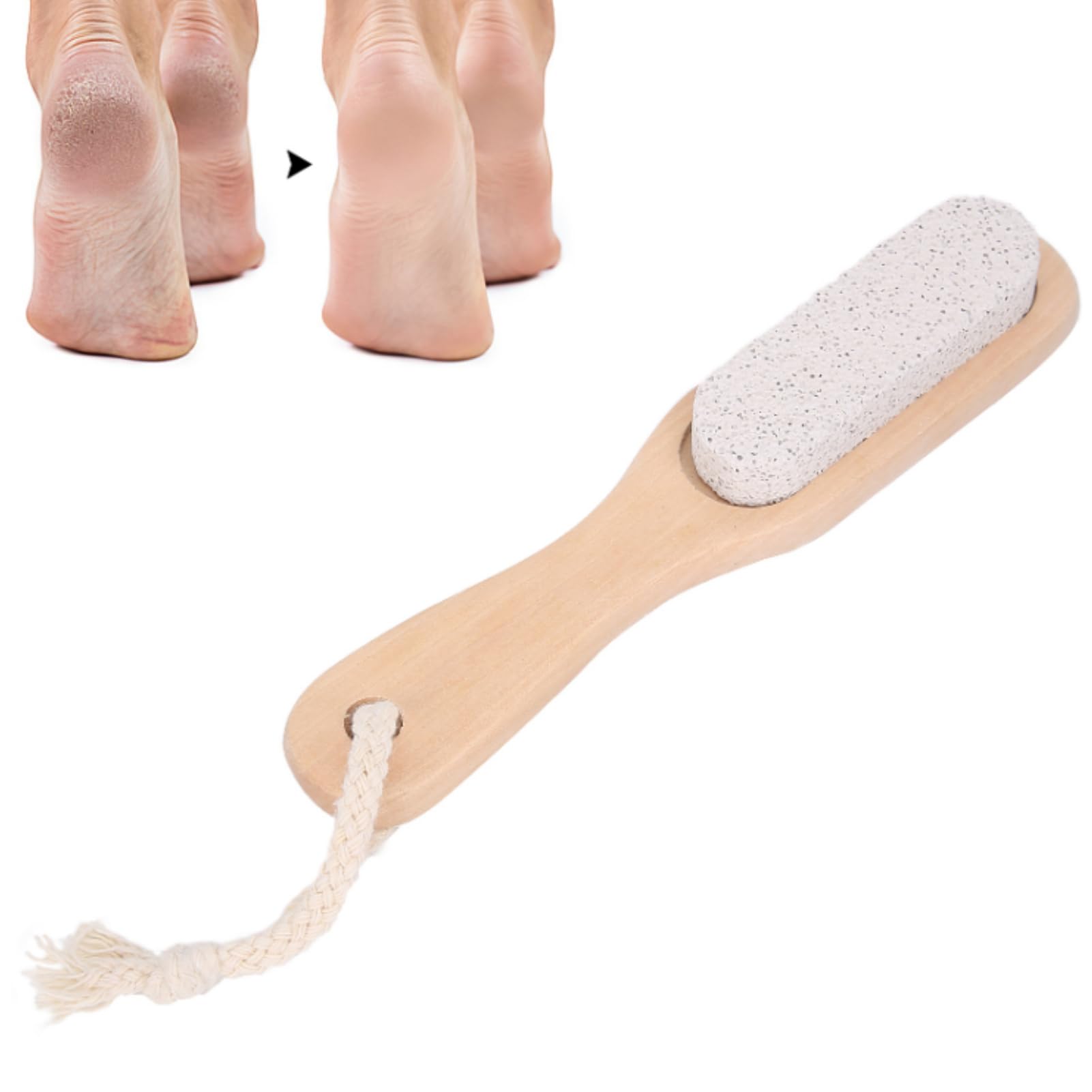 Dioche Foot Stone File - Pumice Stone Foot Pedicure Tool for Callus Removal, Cracked Heels & Dead Skin, Classic Style, 1 Count