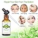 Retinol Serum 2.5% Face Skin Care Night Serum for Facial Eye Moisturizer with Pure Hyaluronic Acid,Glycolic Acid,Jojoba Oil & Aloe Vera Help to Anti Aging & Wrinkle, Acne Repair for All Skin-30ml