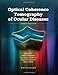 Optical Coherence Tomography of Ocular Diseases