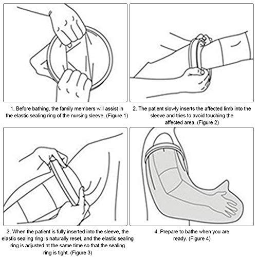 Wendysy Cast and Dressing Cover Cast Covers for Shower Reusable Bandage Cover Waterproof Leg Cast and Bandage Protector Surgery Recover When Bathing for Women and Men