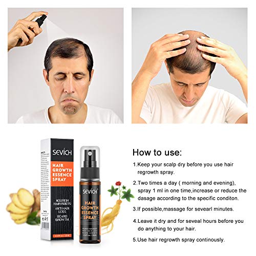 Hair Regrowth Spray, Anti Hair Loss, Thinning, Balding, Natural Ingredients Hair Regrowth Treatment for Stronger, Thicker, Longer Hair Grow,Repair Hair Follicles, All Hair Types, Men and Women
