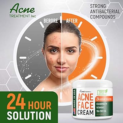 aeno acne treatment