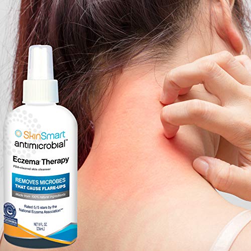 SkinSmart Eczema Therapy Removes Bacteria, so Your Skin Can Heal, Travel Size 2 Ounce Spray (Pack of 3)
