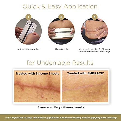 Embrace Active Scar Defense for New Tummy Tuck Scars, FDACleared Extra
