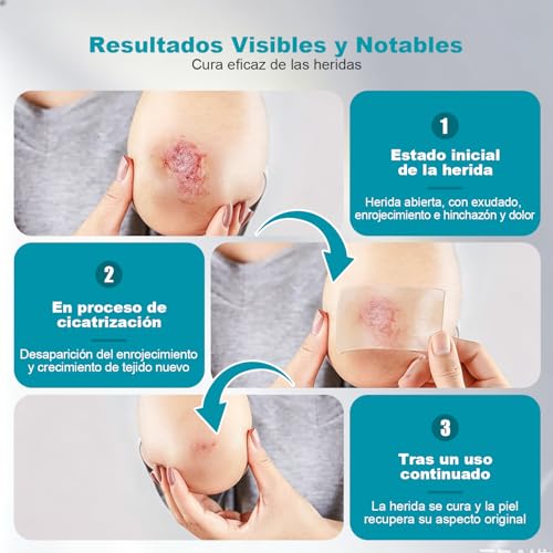 Cinta Hydrocolloid Roll 1.5m x 2PCS, Vendajes de Parches Hidrocoloides 5cm con Autoadhesivo, Ultra Absorbente, Cortable a Medida, Flexible y Impermeable, Kit Esencial de Primeros Auxilios