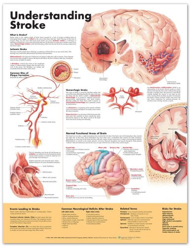 Understanding Stroke Anatomical Chart - //medicalbooks.filipinodoctors.org