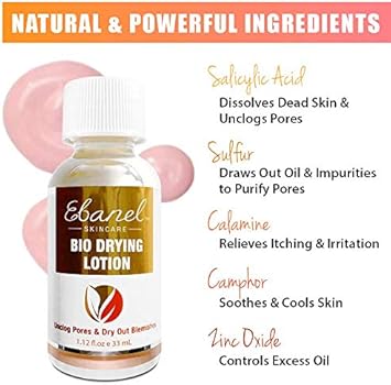 drying lotion on cystic acne