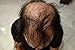 Hair Building Fibers 100 Grams Refill Your Existing Bottle. Highest Grade Fiber By Finally Hair