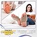 CloudStep Metatarsal Pads for Women, Men with Soft Fabric Compression Sleeve and Gel Cushion for Ball of Feet Support, Forefoot, Bunions, Morton's Neuroma, Metatarsalgia (Size Small)