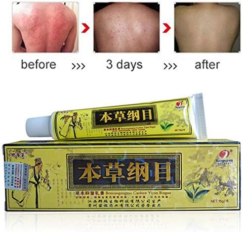 Chinese Natural Herbal Eczema Psoriasis Healing Cream Dermatitis Pruritus Treat & Relief