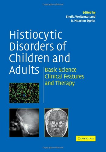 HISTIOCYTIC DISORDERS OF CHILDREN AND ADULTS