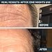 Wrinkles Schminkles Men's Forehead Smoothing Kit, 1-Pack, Reusable Hypoallergenic Silicone Smoothing Pads for Crow's Feet, Puffy Eyes & Dark Circles