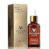 Ochine 30ML Fungal Treatment Essence Onychomycosis Fungal Remover Nail Feet Care Serum