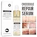 Crocodile Repair Face Serum for Acne Scars, Anti-Aging - Treats Acne, Wrinkles, Stretch Marks - Lightens Old Scars, Removes New Scars - for Men and Women