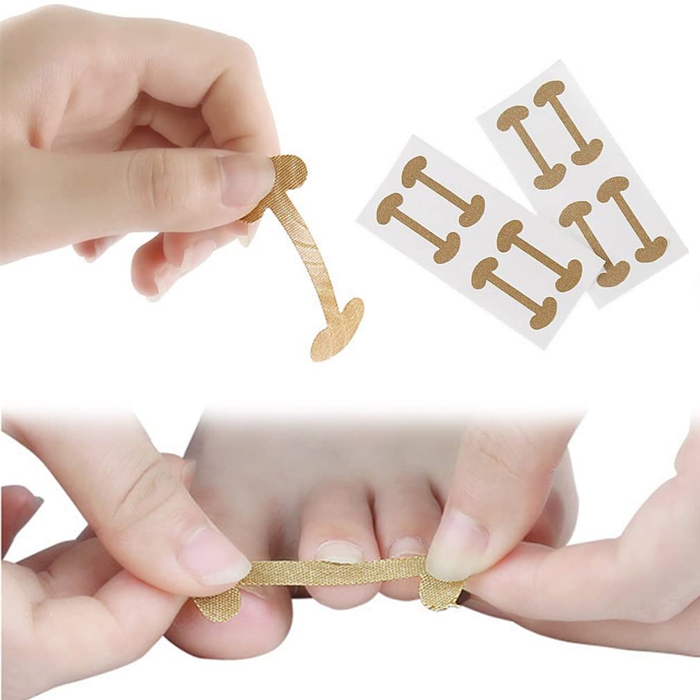 Ingrown Toenails Correction Patch, 20 PCS Physical Straightening Elastic Cotton Glue Patch Toenail Pedicure Tool, Curved Toenails Brace Thick Paronychia Correction Recover Treatment