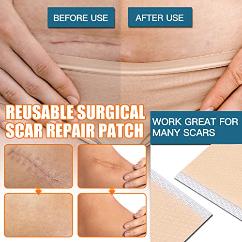 Silicone Scar Sheets (2 Rolls), Medical Grade Silicone Scar Tape, Scar Removal Strips for Acne, Burn Scars C-Section & Keloid Surgery Scars Sheets Treatment Sheets - 8 Month Supply