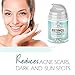Retinol Face Moisturizer for Women – Anti Aging & Wrinkles Cream that Worksthumb 2