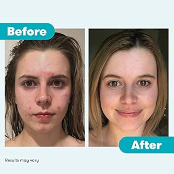 proactiv md daily oil control moisturizer spf 30