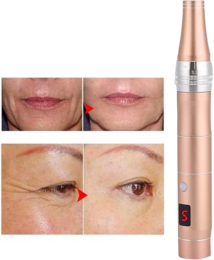 micro needle therapy