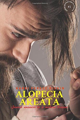 Alopecia Areata: Jewish Answers to a Modern Disease