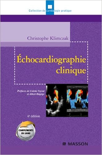 Echocardiographie Clinique Cardiologie Pratique Klimczak Christophe 9782294706059 Amazon Com Books
