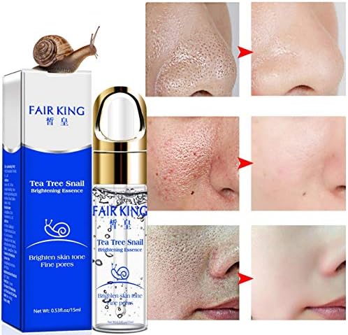 Abbra Tea Tree Snail Brightening Essence Oil Liquid Brighten Skin Tone Fine Pores Face Serum Skin Care