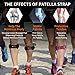 CAMBIVO 2 Pack Patella Knee Brace With Etra Strap, 6 Color Knee Braces for Knee Pain, Adjustable Knee Brace Patellar Tendon Stabilizer Support Band for Knee Pain Relief, Jumpers Knee, Tendonitis, Basketball, Running, Hiking, Volleyball, Tennis, Squats (Orange)