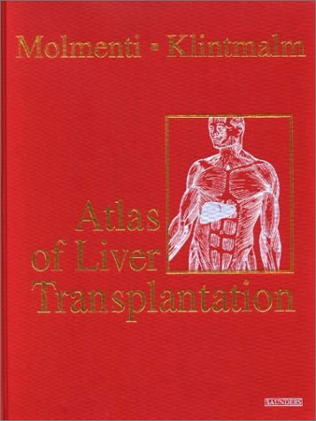 Atlas Of Liver Transplantation