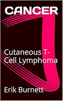 download hyperbolic partial differential