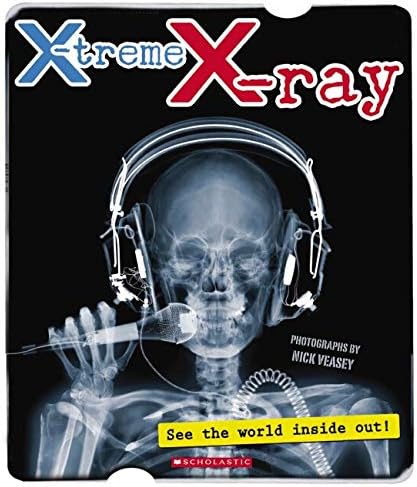 X-treme X-ray: See the World Inside Out!
