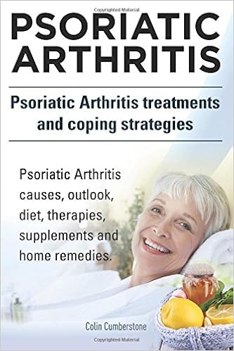 Psoriatic Arthritis Psoriatic Arthritis Treatments And - 
