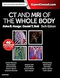 Computed Tomography & Magnetic Resonance Imaging Of The Whole Body E-Book