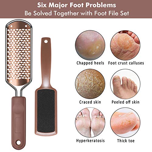 Foot File Pedicure Foot Scrubber Double-sided Callus Remover INFELING Stainless Steel Callus File Large Foot Rasp Grater for Wet and Dry Feet (3 Pack)