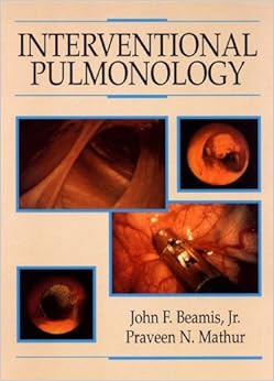 Interventional Pulmonology Interventional Pulmonology