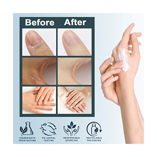 Hand-Cream-Gift-SetwFoot-Cream-Lip-Balm10-Packs-Christmas-for-Very-Dry-Hands-CareXmas-Birthday-Valentines-Mothers-Day-Gifts-Ideas-for-Women-Men-Mum-Her-Ladies-Grandma-Girls-Wife-Girlfriend Hand Cream Gift Set,w/Foot Cream & Lip Balm,10 Packs Christmas for Very Dry Hands Care,Xmas Birthday Valentines Mothers…