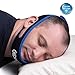 Gideon Ultra Comfortable and Adjustable Anti-Snoring Chin Strap – Instant Stop Snoring - Simple, Fast and Natural Snore Relief [UPGRADED VERSION]