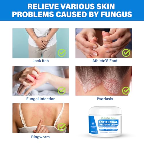 Skin Fungus Cream, Foot Fungus Relief Quick Intensive, Antibody Ringworm, Eczema, Sweat Bubbles, Non-Irritating, Suitable for Face and Body Care, 60 g