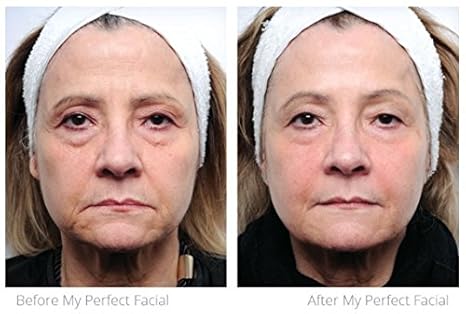 my perfect eyes facial kit