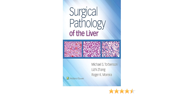 Amazon Com Surgical Pathology Of The Liver Ebook Torbenson Michael Moreira Roger Zhang Lizhi Kindle Store